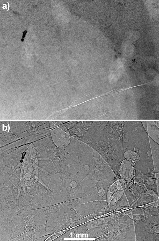 a) radiography of an amber block with inclusions in absorption mode. b) the same radiograph in propagation phase contrast mode with 990 mm of propagation distance (pixel size: 5 µm).