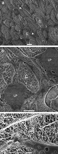 Structure of Vernix caseosa (VC) is characterised by corneocytes embedded in lipid domains.